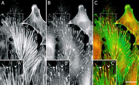 Immunolabelling Of Ena Vasp Proteins At Focal Contacts In Cultured