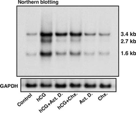 A Representative Autoradiogram Of A Northern Blot Upper Panel