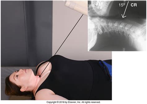 Chapter 8 Positioning Cervical Thoracic Spine Flashcards Quizlet