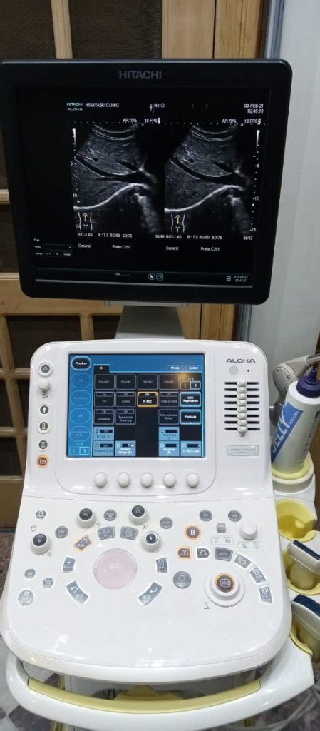 ARIETTA 60 Hitachi Aloka Medical Equipment Consultant