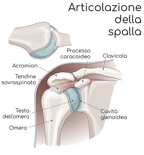 Lussazione Di Spalla Cause Sintomi E Cura