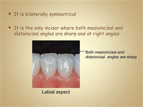 Morphology Of Mandibular Central And Lateral Incisors Teeth