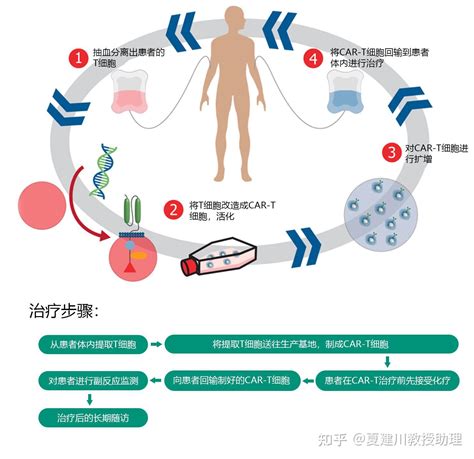 一文读懂细胞免疫治疗的种类和原理 知乎