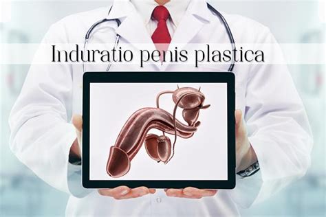 Induratio Penis Plastica Bologna Andrologia Bologna Equipe S Orsola