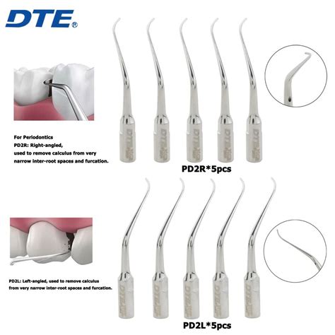 Woodpecker puntas de escalador Periodontal ultrasónico Dental