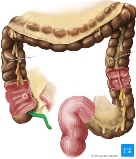 Appendix Vermiformis Wurmfortsatz Anatomie Funktion Kenhub