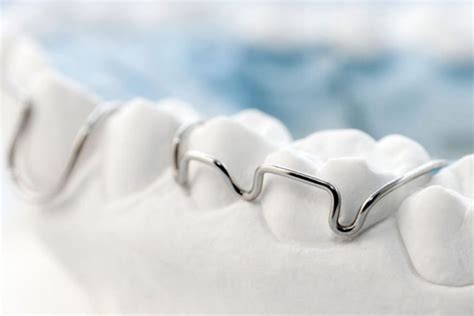 Orthodontic Retention Retainers Cumming Georgia Cummings Pediatric Dentistry And Orthodontics