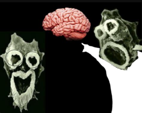 Electron Microscope Images Of Brain Eating Amoeba Naegleria Fowleri