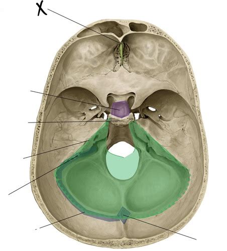 Anat D Lecture Cranial Fossae Cranial Nerves Meninges Eyes