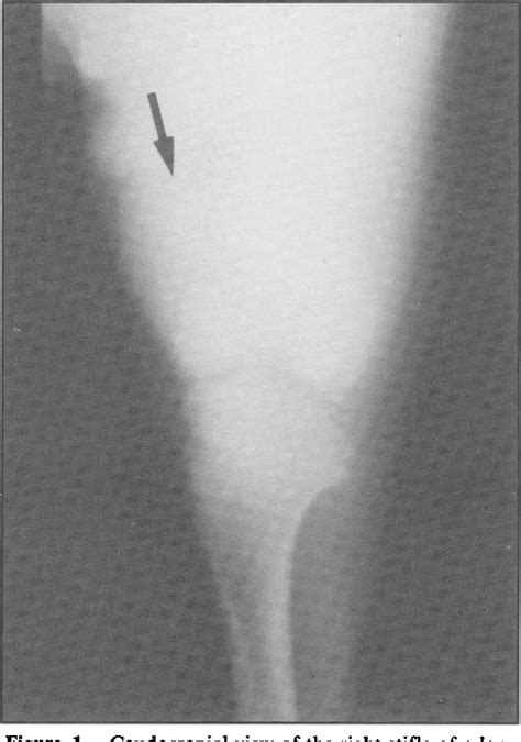 Figure 1 From Surgical Correction Of Medial Luxation Of The Patella In