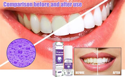 V Purple Colour Corrector Toothpaste For Teeth Whitening Stain