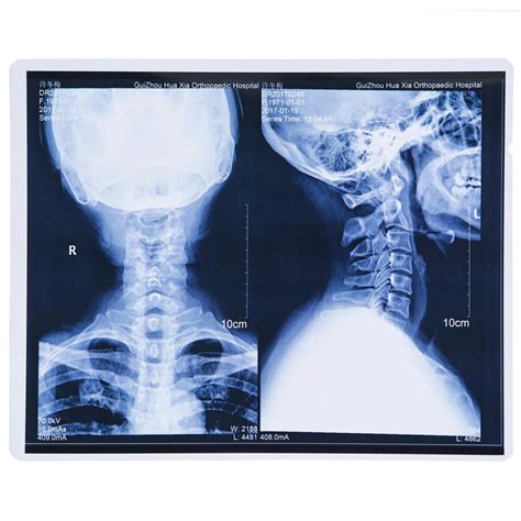 FUJI Printer Using Laser Medical X Ray Film 35X43 Cm Guangzhou Pure