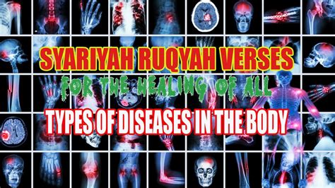 Extremely Powerful Al Quran Ruqyah To Remove All Types Of Diseases