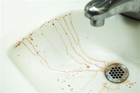 Free Stock Photo Of Bathroom Bathroom Sink Bloody