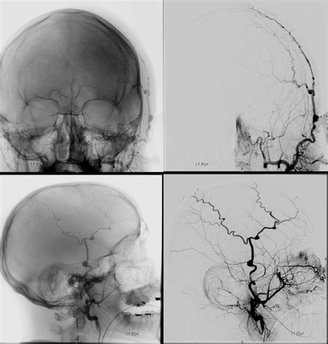 Superficial Temporal Artery Atelier Yuwa Ciao Jp