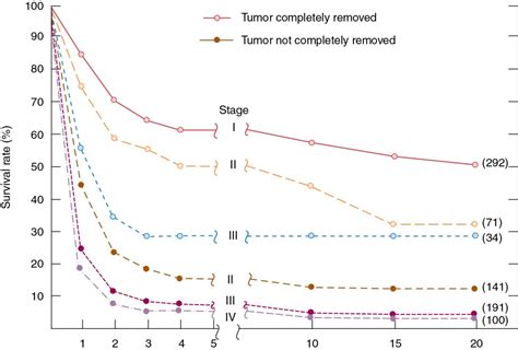 Epithelial Ovarian Cancer Oncohema Key