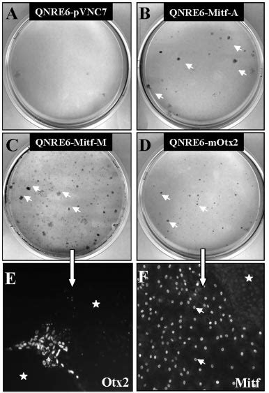 OTX2 Induces A Pigmented Phenotype In Transfected Quail Retina Cells