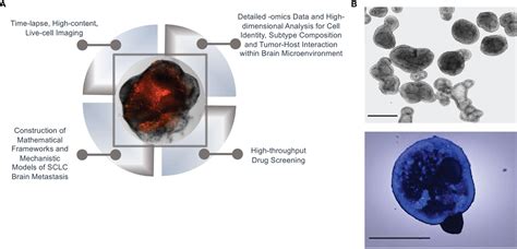 Frontiers Organoids As A Systems Platform For Sclc Brain Metastasis