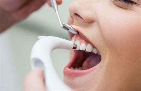 Best Dentist In Sydney Sydney Cbd Dentistry