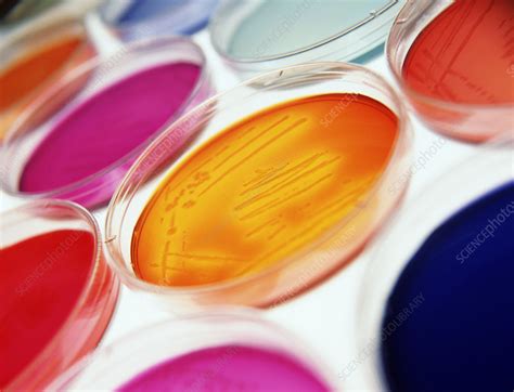 Petri Dishes Containing Bacterial Cultures Stock Image M8740447