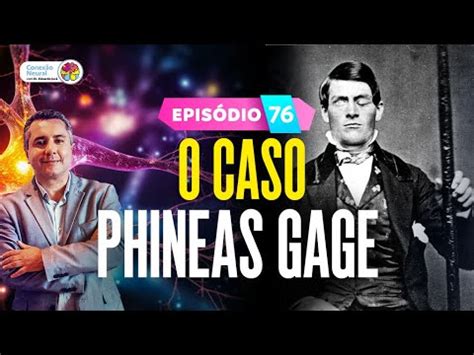 O Caso Phineas Gage Ep Youtube