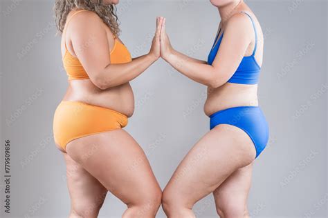 Two Overweight Women With Cellulitis Fat Flabby Bellies Legs Hands Hips And Buttocks On Gray