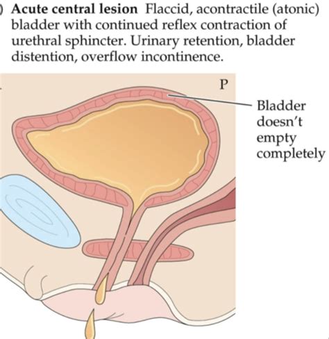 Micturition Bladder Control Flashcards Quizlet