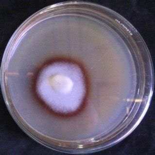 Screening Of A Laccase B Lignin Peroxidase C Manganese Peroxidase