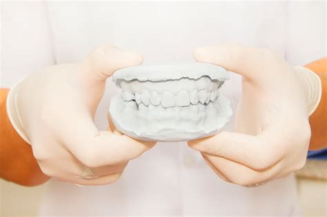 Cómo abrir un laboratorio de prótesis dental Blog Dental Irriak