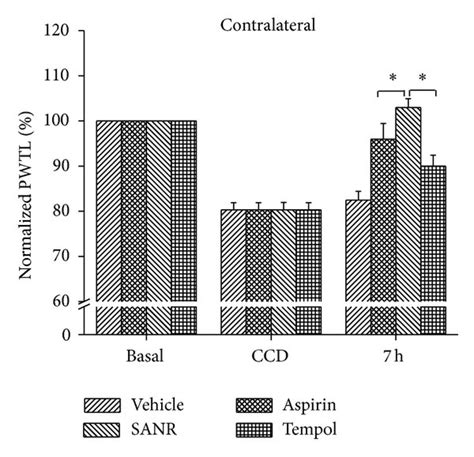 Acute Treatment Of Sanr Produces Antinociceptive Effect On Ccd Induced