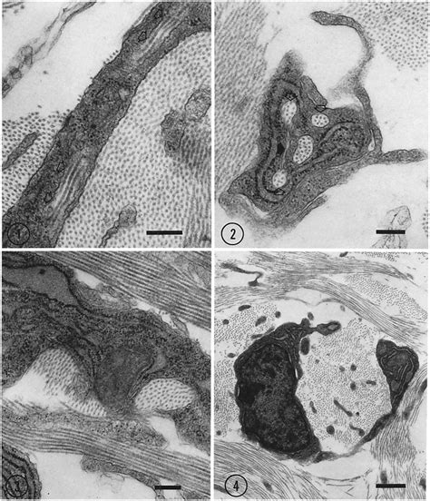 Transmission Electron Micrographs Of Fibroblasts From 14 D Stage 40