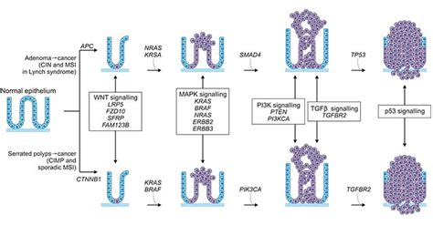 Familial Adenomatous Polyposis Progression