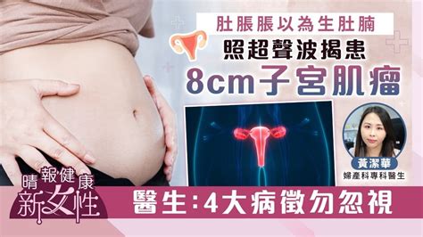 健康新女性｜肚脹脹以為生肚腩 照超聲波揭患8cm子宮肌瘤 醫生：4大病徵勿忽視 晴報 健康 女性疾病 D231013