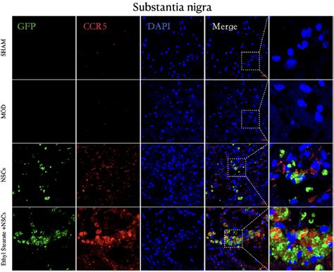 Immunofluorescence Staining Of Ccr5 In The Substantia Nigra After