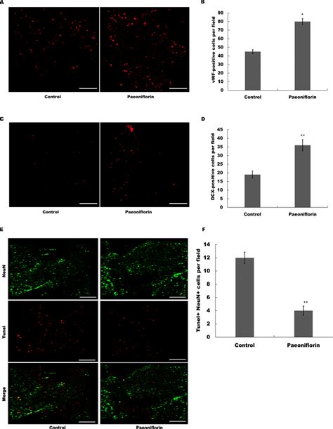 Paeoniflorin Facilitated Neurogenesis And Vasculogenesis In Rat Stroke