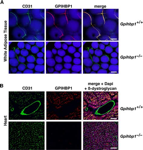 GPIHBP1 Is Responsible For The Entry Of Lipoprotein Lipase Into