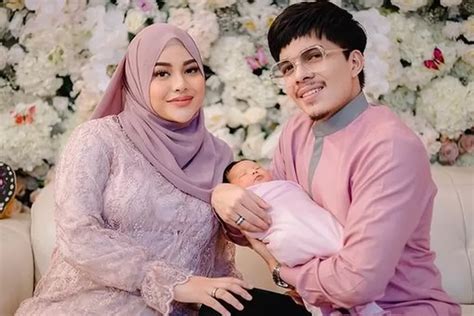 Anak Kedua Aurel Hermansyah Azzura Humaira Idap Penyakit Eksim