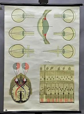 Vintage Mural Rollable Medical Wall Chart Grelly USA