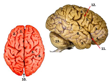 NS 102 Week 4 Lab Human Neuroanatomy Flashcards Quizlet