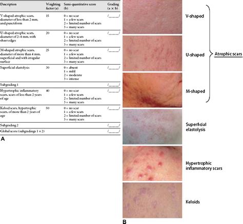 New Insights Into The Management Of Acne An Update From The Global