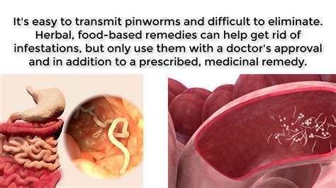 Get Rid Of Pinworms How To Treat Pinworms Ways To Treat Human