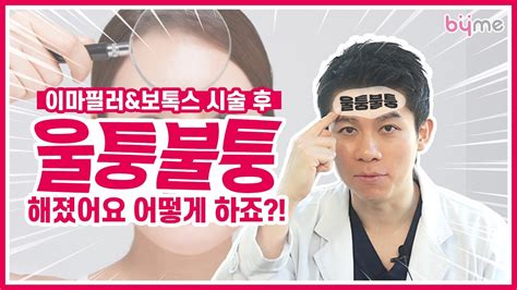 이마 보톡스 부작용 이마 필러 보톡스 울퉁불퉁해졌어요 어떻게 하죠 이마미간눈가주름 위픽뷰티