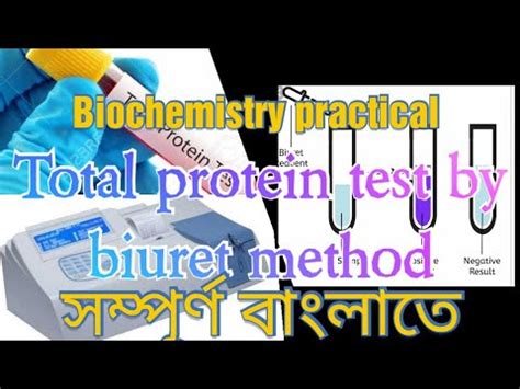 Total Protein Estimation By Biuret Method Biochemistry Practical For