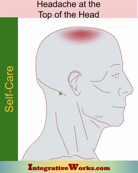 Stiff Neck Pain Patterns And Self Care Integrative Works