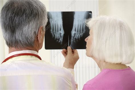 X-ray diagnosis - Stock Image - M415/0617 - Science Photo Library