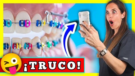 Lámpara Filosofía Taquigrafía Mejores Colores Para Brackets Sucio Sabor