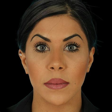 patient   afters    dr anil shah