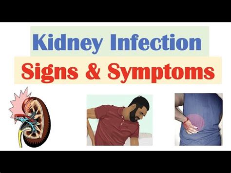 Learn Pyelonephritis Kidney Infection Causes Pathophysiology Signs