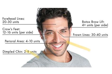 How Much Brotox Do You Need We Had A Request To Post How Many Units Are Typically Required By