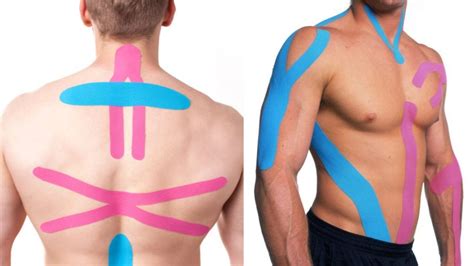 Beneficios Del Vendaje Neuromuscular O Kinesiotape